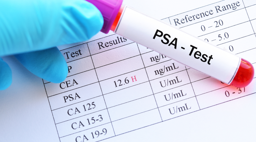 Psa Uk Get a PSA test – Now – Manchester Men Speak Up